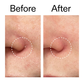 Product label image listing salicylic, succinic acids and ectoin in The INKEY List formula