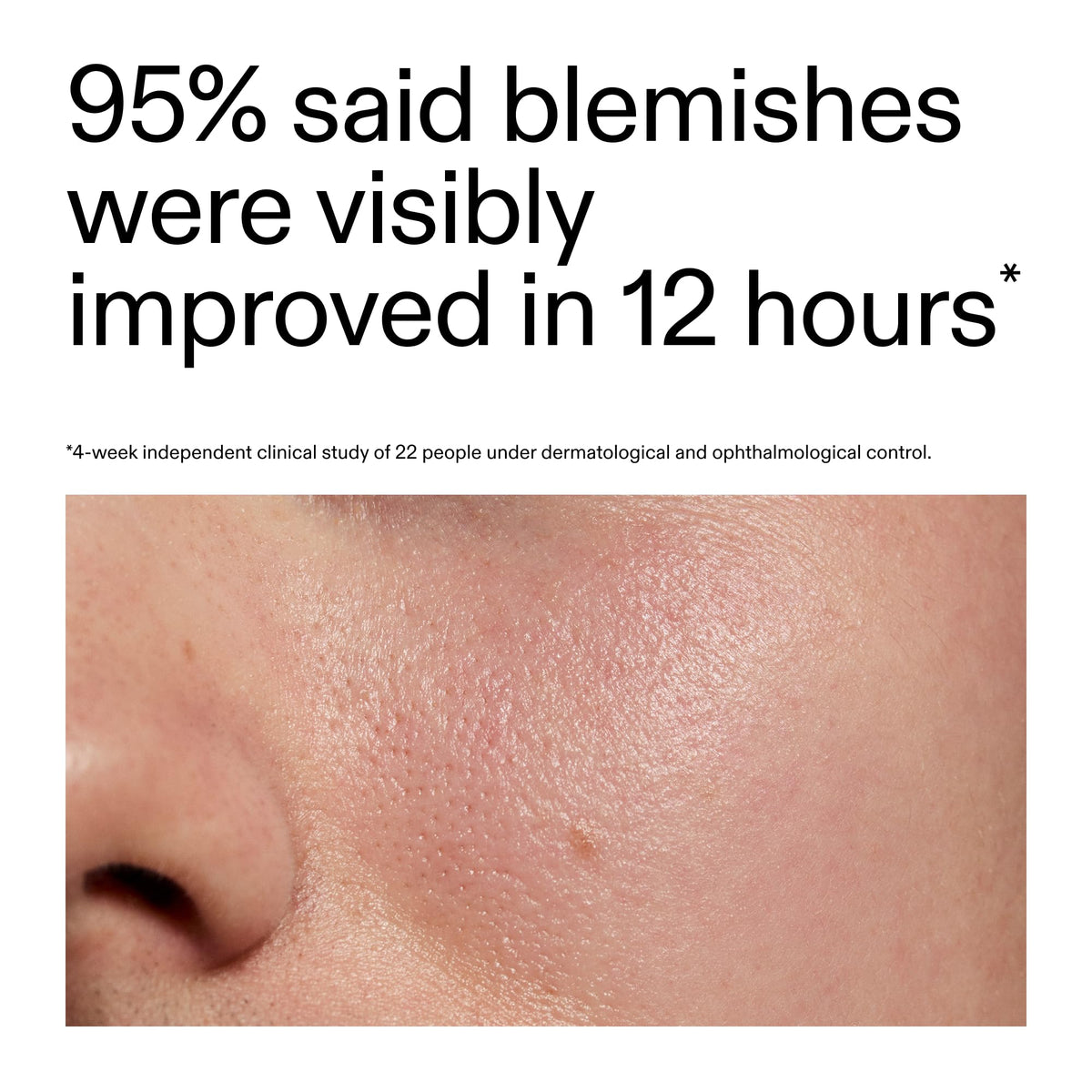 The INKEY List cream on fingertip ready to apply, highlights precise targeted use benefit