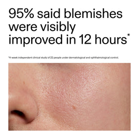 The INKEY List cream on fingertip ready to apply, highlights precise targeted use benefit
