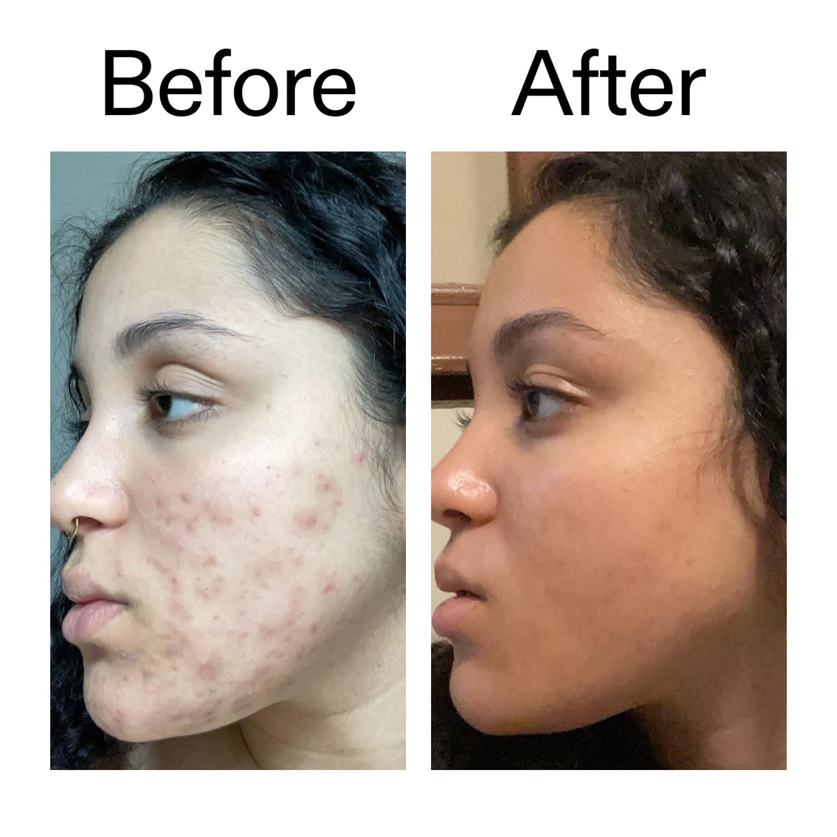The INKEY List serum being applied at night to support even skin tone
