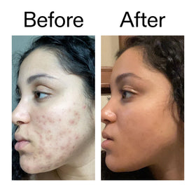 The INKEY List serum being applied at night to support even skin tone