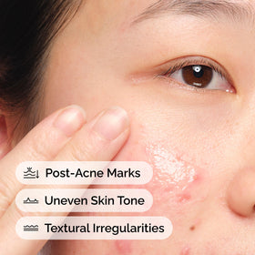 The Ordinary clear label detail highlighting active ingredients and reassurance benefit