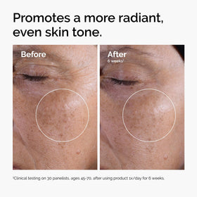 Close-up of The Ordinary label highlighting glycolic acid strength and clarity