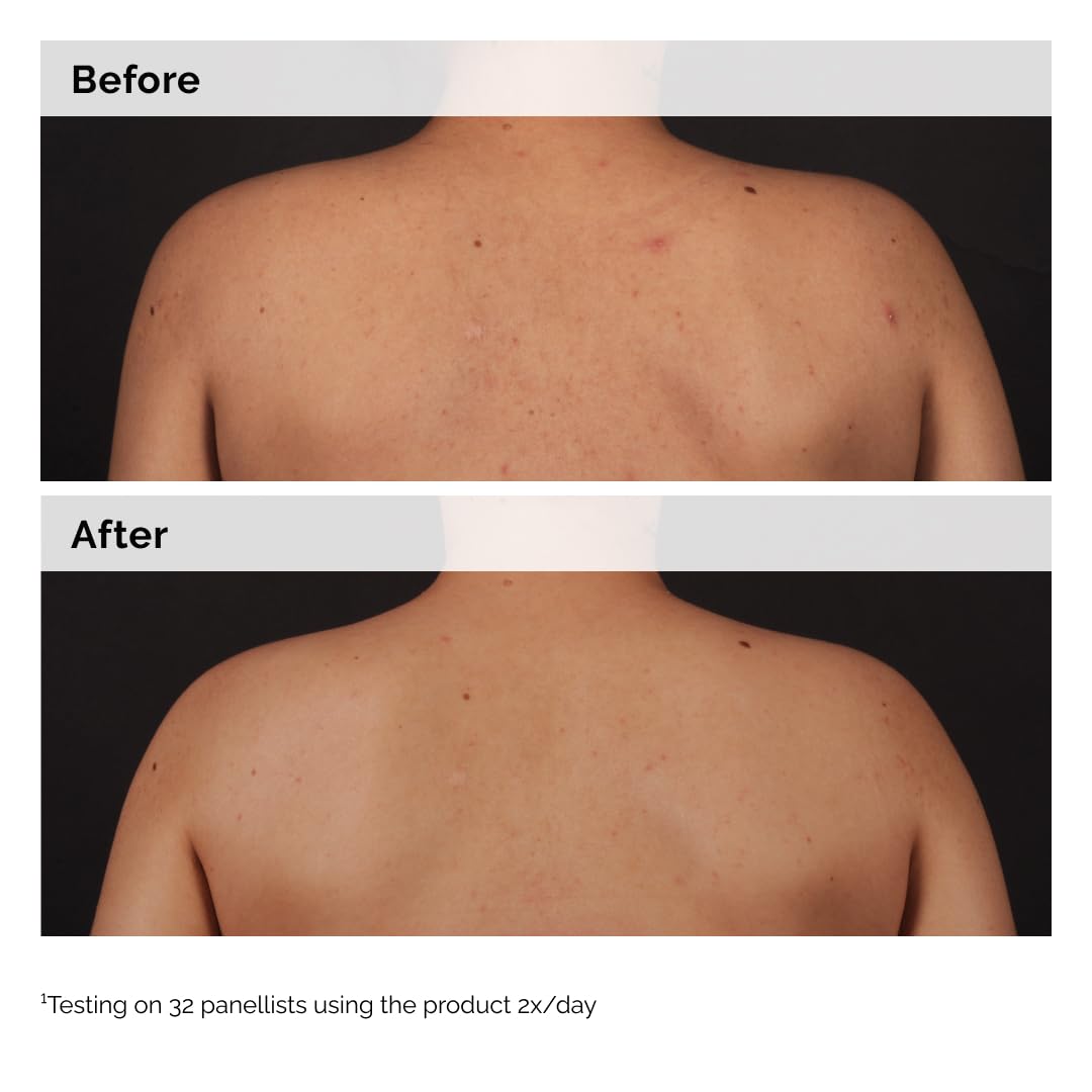 The Ordinary product label and ingredients close-up showing transparent formulation