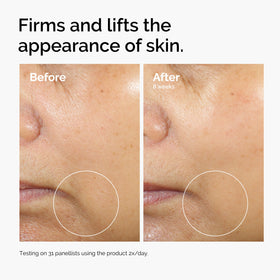 The Ordinary serum on bathroom counter in morning routine lifestyle shot