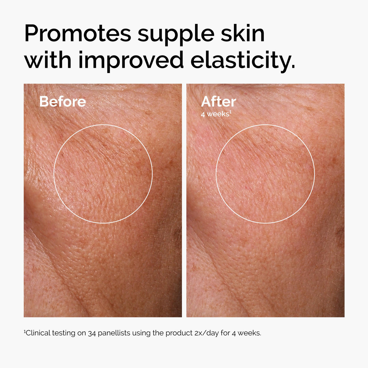 The Ordinary niacinamide pipette detail highlighting oil-control properties