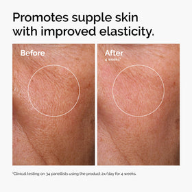 The Ordinary niacinamide pipette detail highlighting oil-control properties