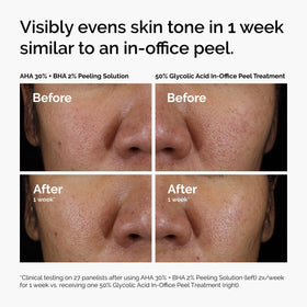 The Ordinary packaging and ingredients label highlighting formulation transparency and safety