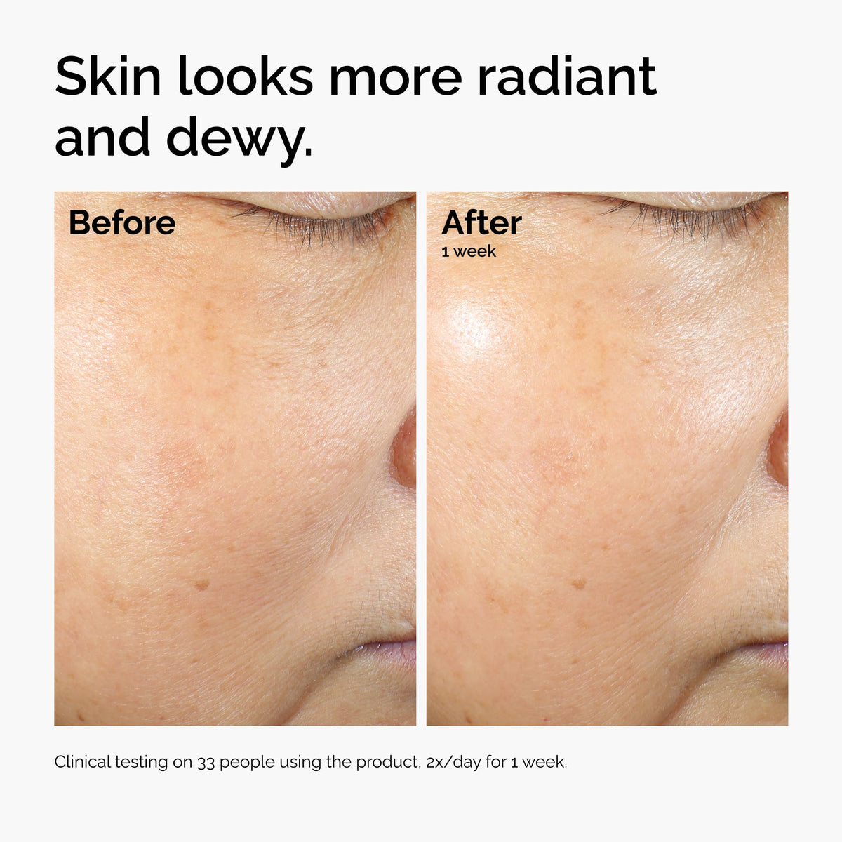 The Ordinary product being smoothed onto skin showing dewy finish and calming effect