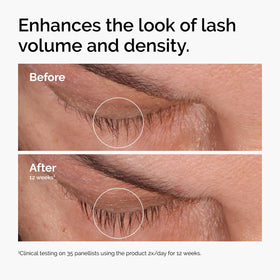 The Ordinary serum placed on bathroom vanity demonstrating daily routine integration benefit