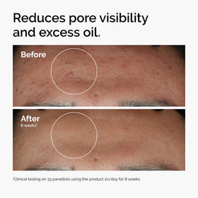 The Ordinary serums staged in bathroom routine for easy daily use