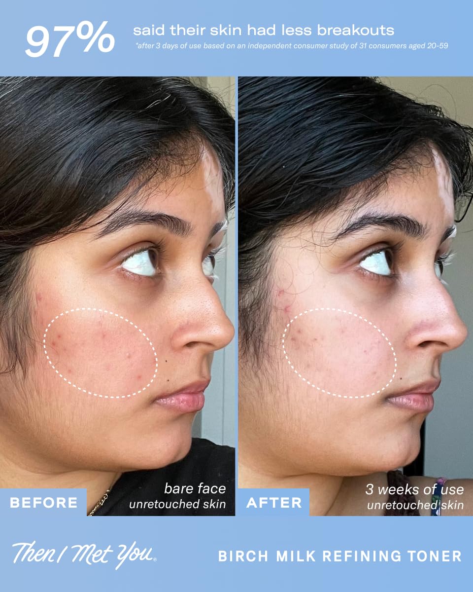 Then I Met You with hyaluronic visual representing moisture retention benefit
