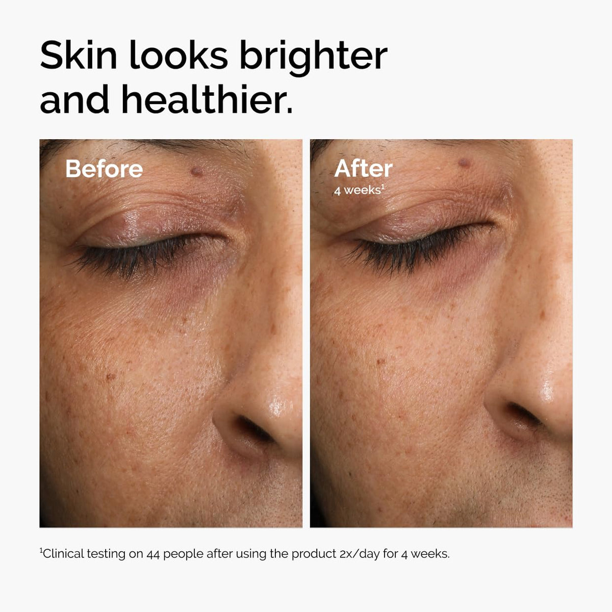 The Ordinary ingredients closeup highlighting antioxidant blend and clarity