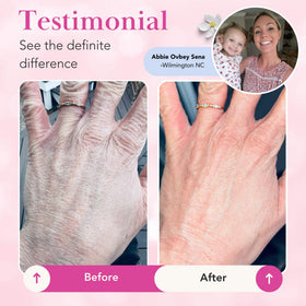 Theraplex clear lotion texture droplet on fingertip showing light absorption