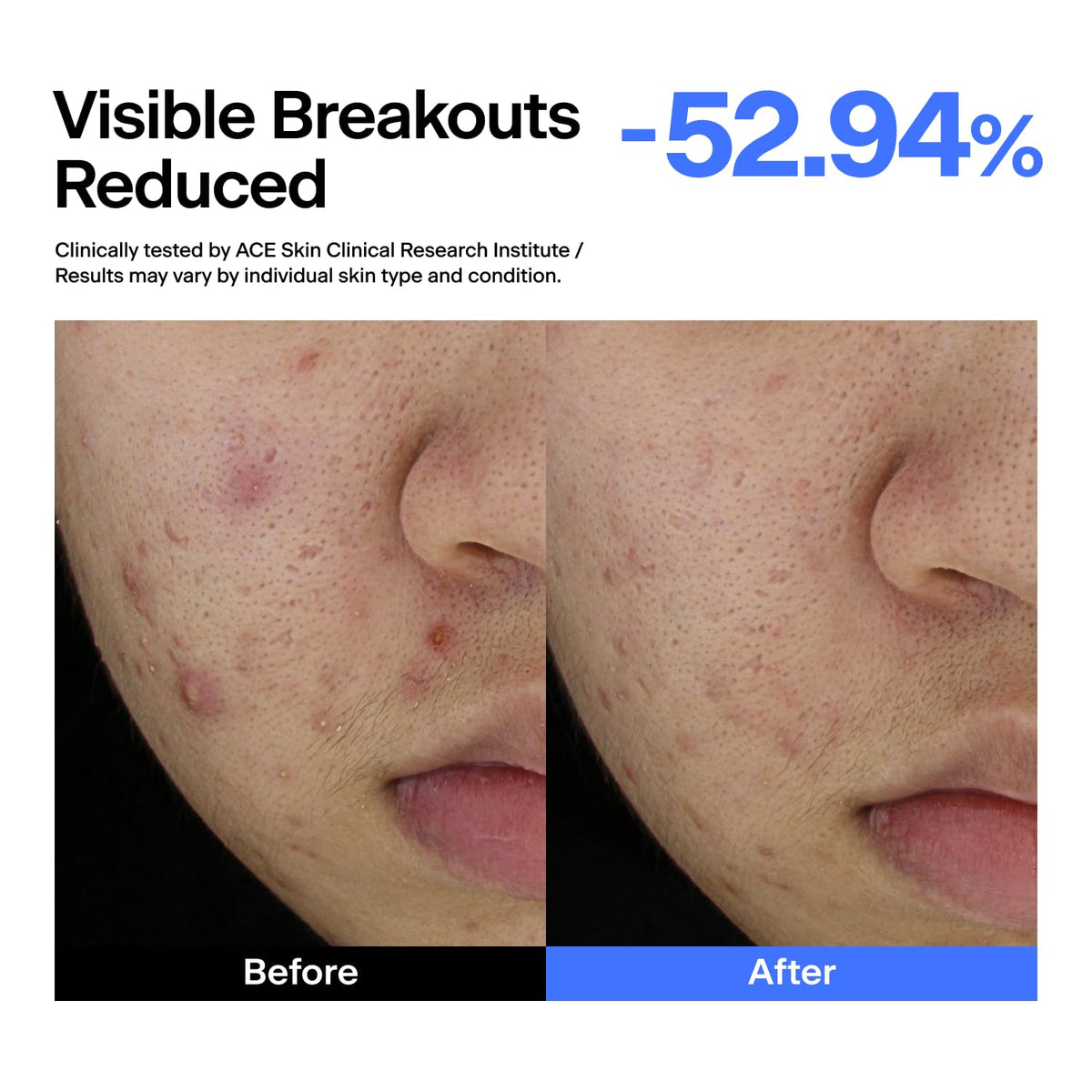 THOME serum being applied to skin, illustrates calming effect and smoothing benefit