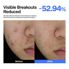 THOME serum being applied to skin, illustrates calming effect and smoothing benefit