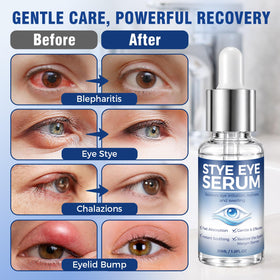 Tiepetly dropper dispensing clear serum onto fingertip for precise application benefit convenience