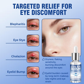 Tiepetly in-use image applying drops to eyelid while massaging to relieve irritation benefit relief