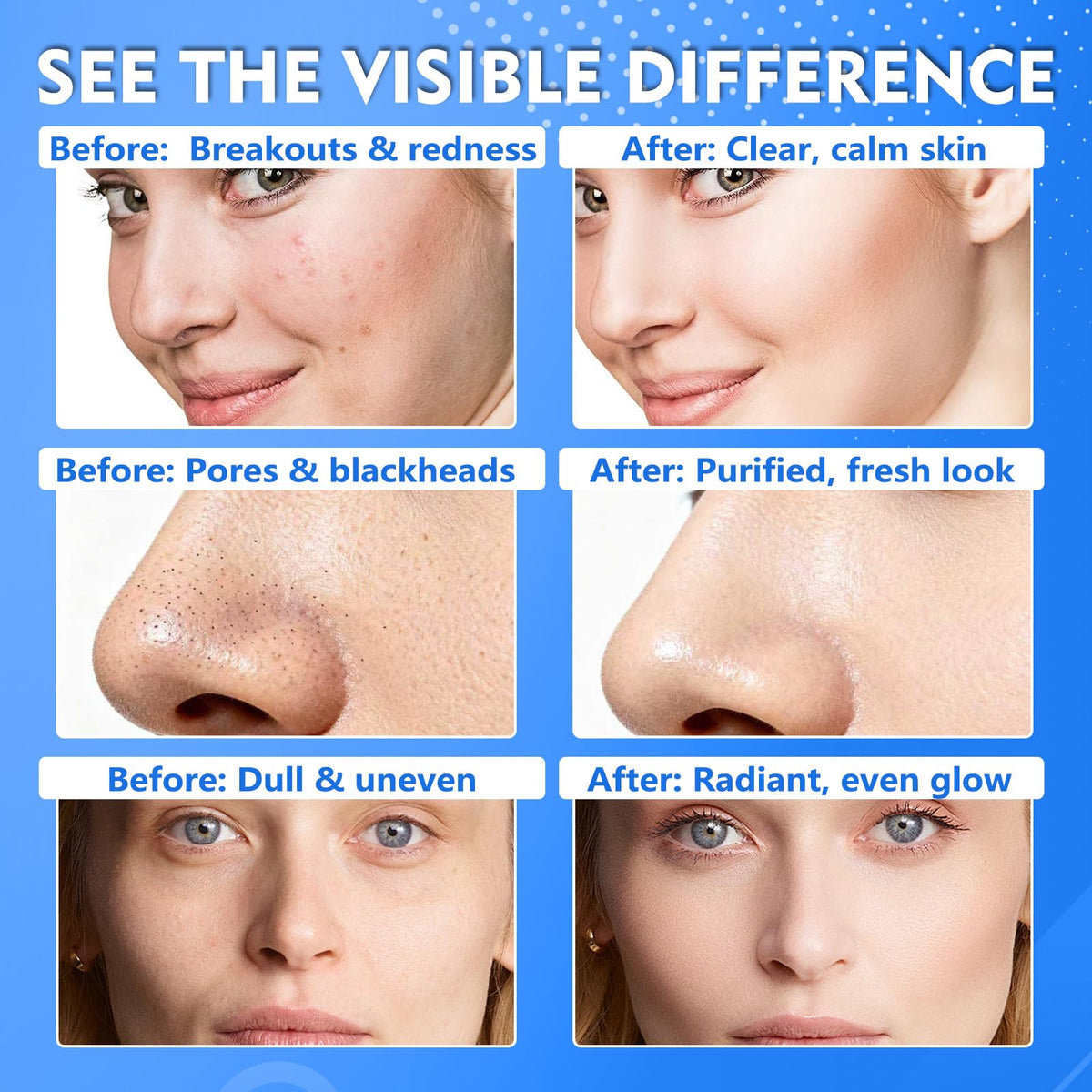 Tiepetly pad applying to cheek demonstrating gentle exfoliation and smooth results