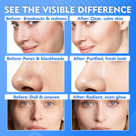 Tiepetly pad applying to cheek demonstrating gentle exfoliation and smooth results