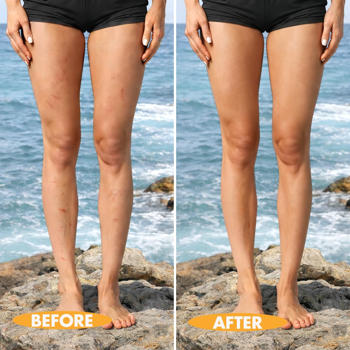 Timmi Beauty before after split image demonstrates effective coverage and realism