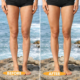 Timmi Beauty before after split image demonstrates effective coverage and realism