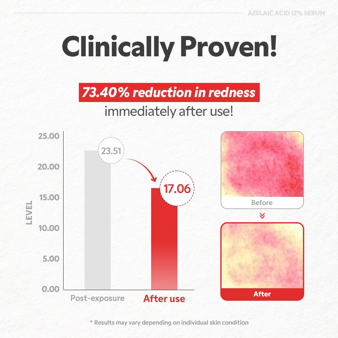 TIRTIR applying serum on hand to show spreadability and immediate hydration benefit