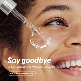 TIRTIR serum dropper releasing clear gel, demonstrating controlled application benefit