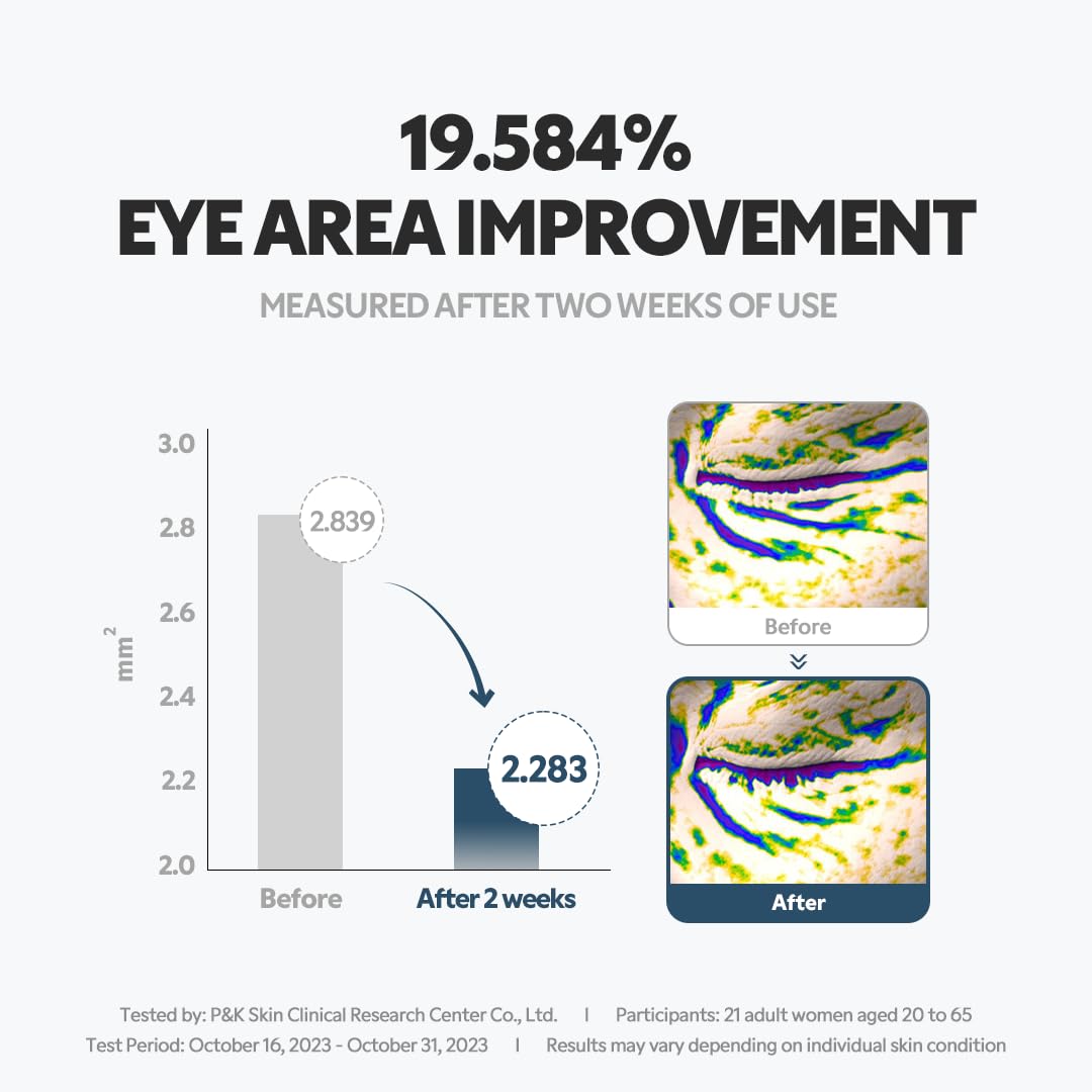 TIRTIR before and after illustration showing smoother under-eye area