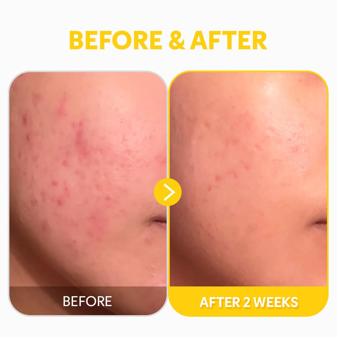 TIRTIR before and after illustration indicating brighter, more even tone