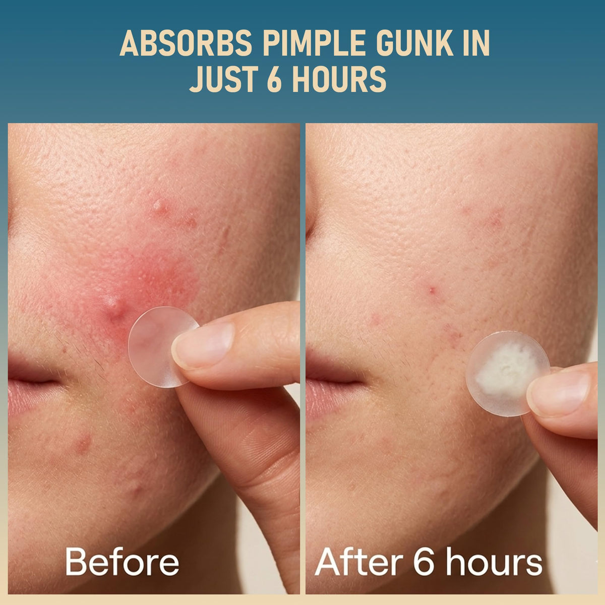 tkgou patch applied on cheek demonstrating discreet protection and coverage