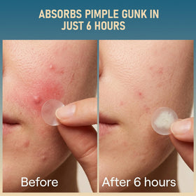 tkgou patch applied on cheek demonstrating discreet protection and coverage