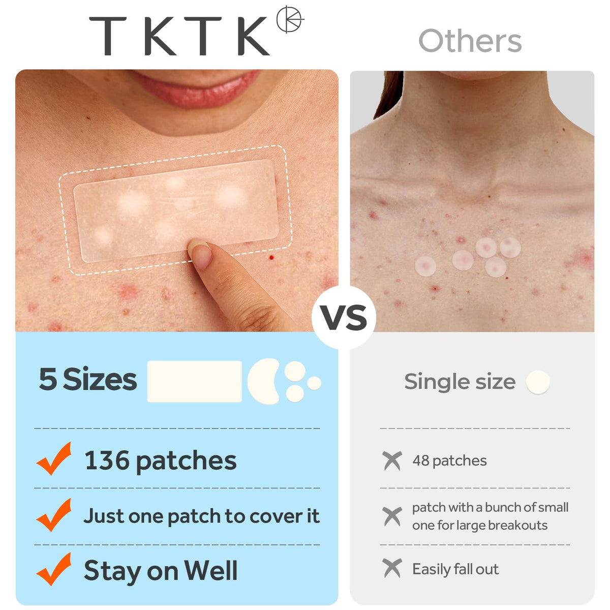 TKTK patches on chest and back treating larger breakouts