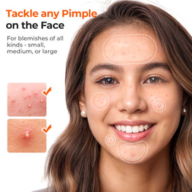 TKTK five sizes laid out to show correct fit options for different pimples