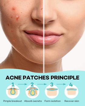 TKTK patch worn overnight on jawline illustrating secure adhesion during sleep