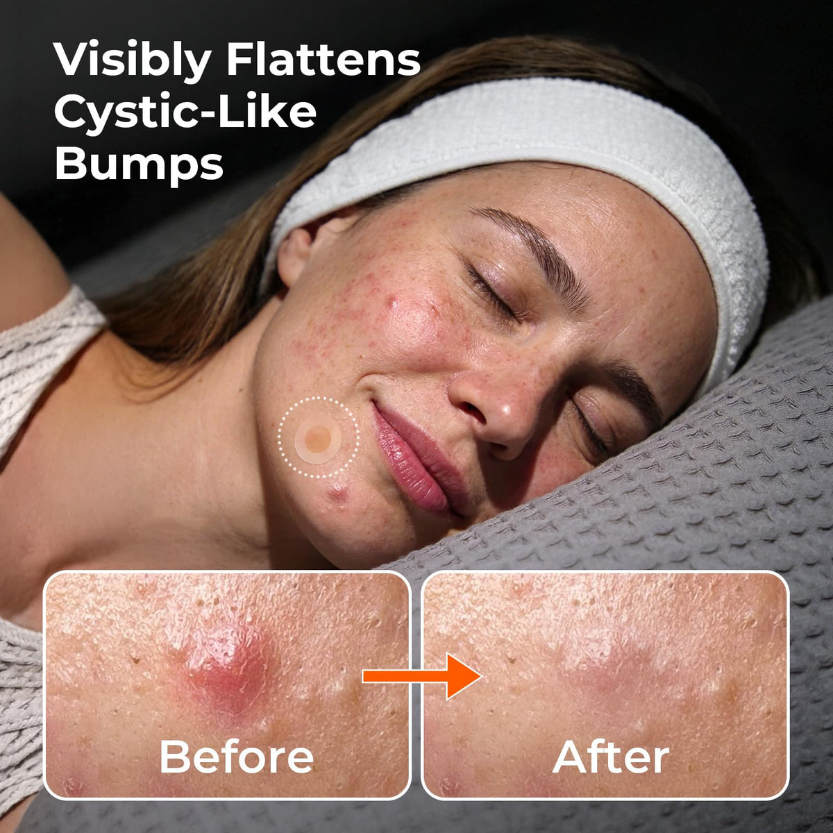TKTK patch applied on skin demonstrating targeted coverage and discreet wear