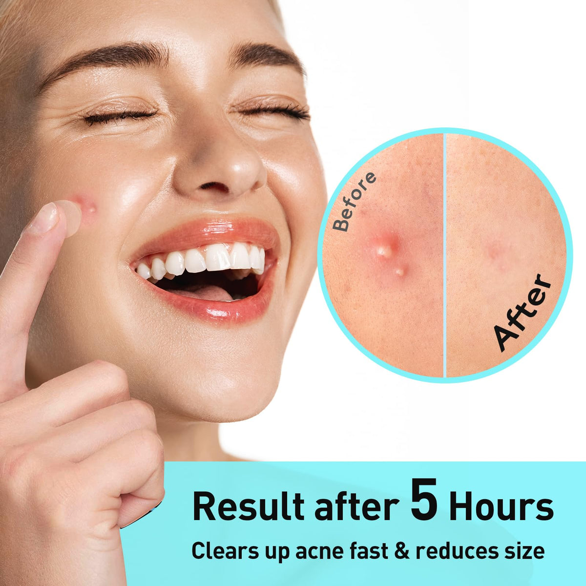 TKTK willow bark and salicylic acid concept showing natural ingredient benefit