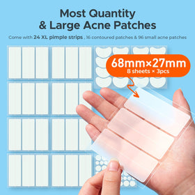 TKTK close-up of 68x27mm XL strip demonstrating wide coverage