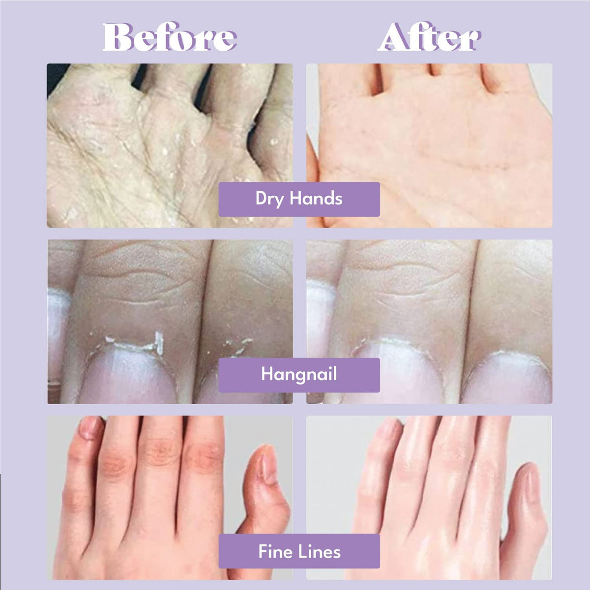 TOI:L hand mask in use on hands demonstrating quick at-home treatment benefit