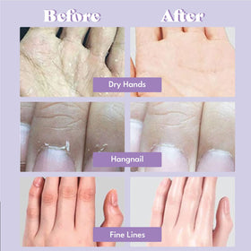 TOI:L hand mask in use on hands demonstrating quick at-home treatment benefit
