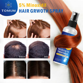 TOMUM label and ingredient panel showing 5% minoxidil concentration for clarity