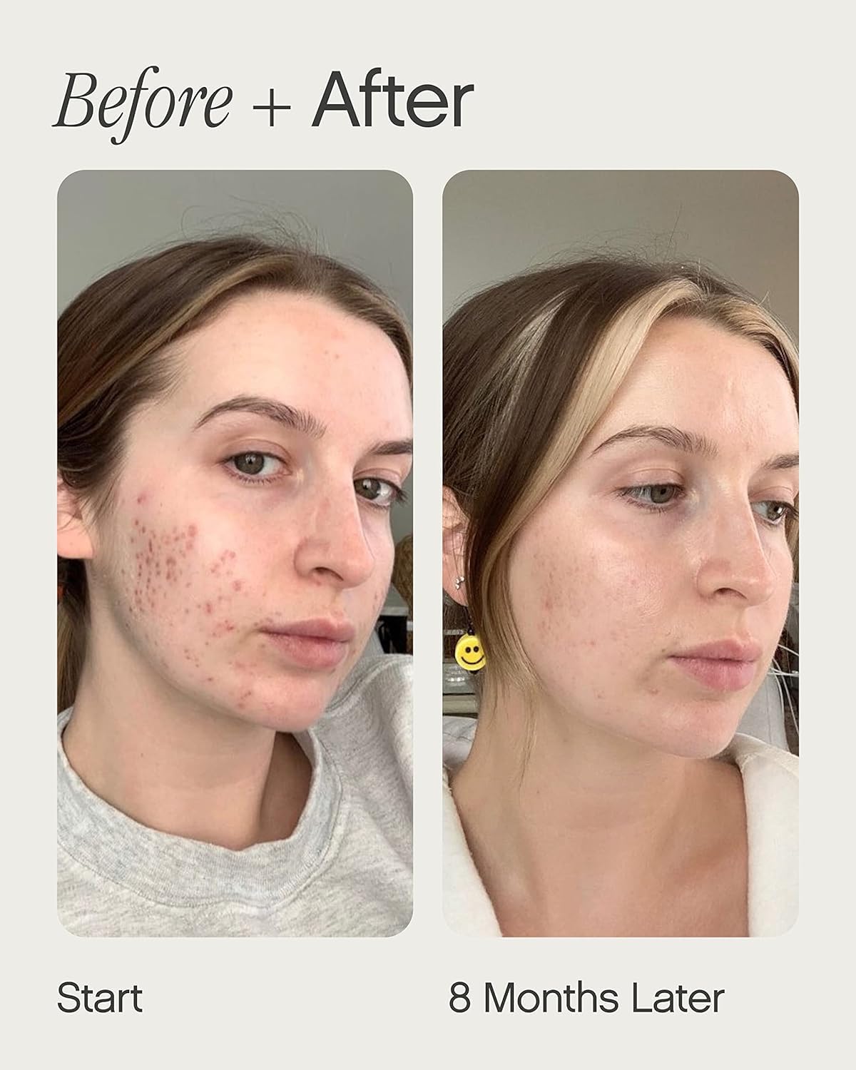 Topicals close-up label highlighting kojic acid and niacinamide for brightening