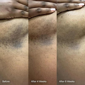 Topicals creamy foam on skin demonstrating gentle cleansing