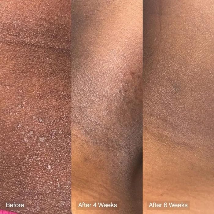 Topicals bar next to moisturizer illustrating layered routine