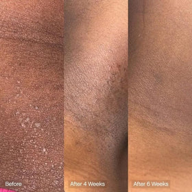 Topicals bar next to moisturizer illustrating layered routine