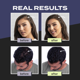 Hand applying Toppik shaker demonstrating easy precision and coverage benefit