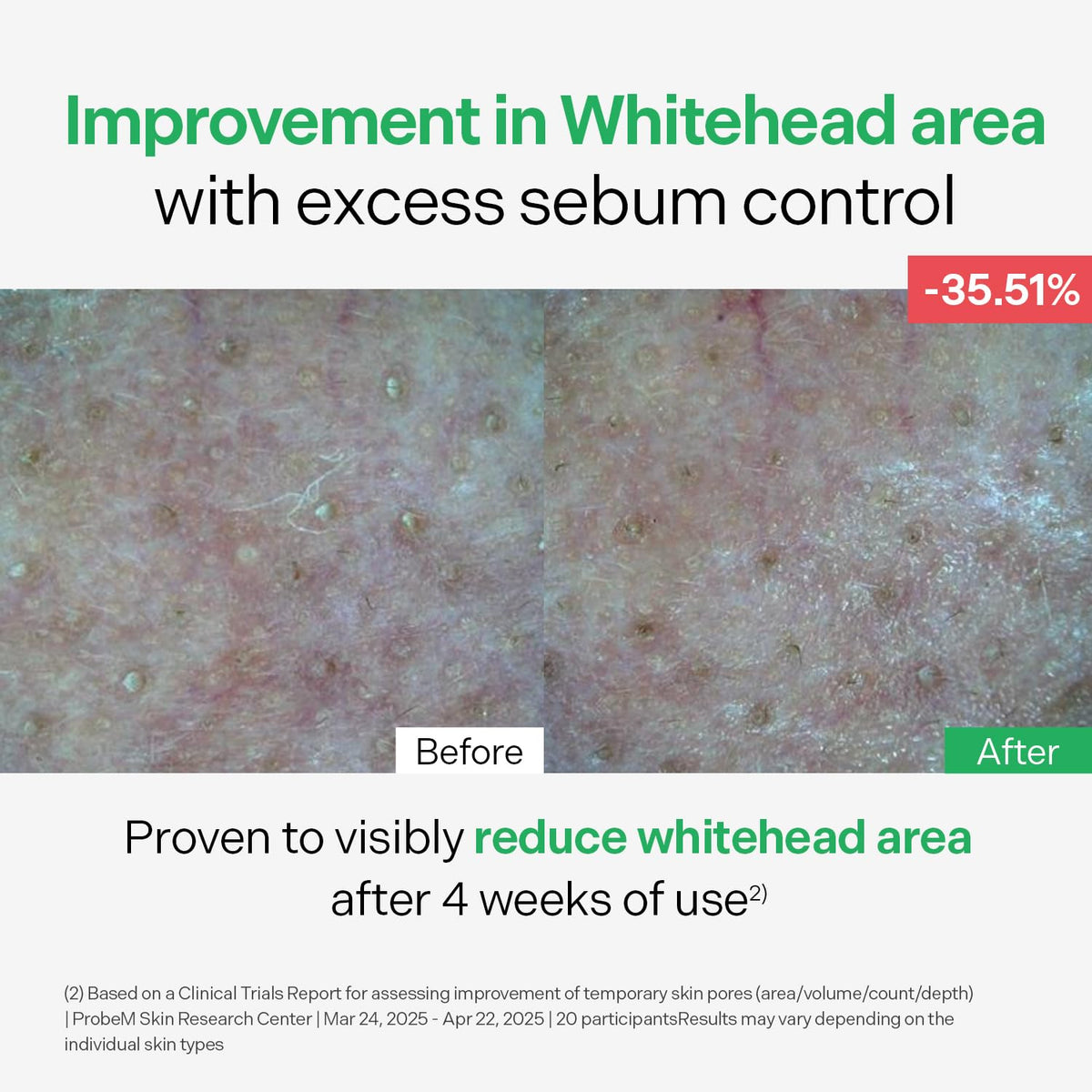 Torriden on skin being absorbed, shows non-greasy finish