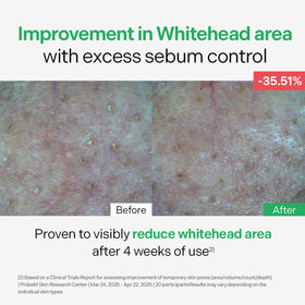Torriden on skin being absorbed, shows non-greasy finish
