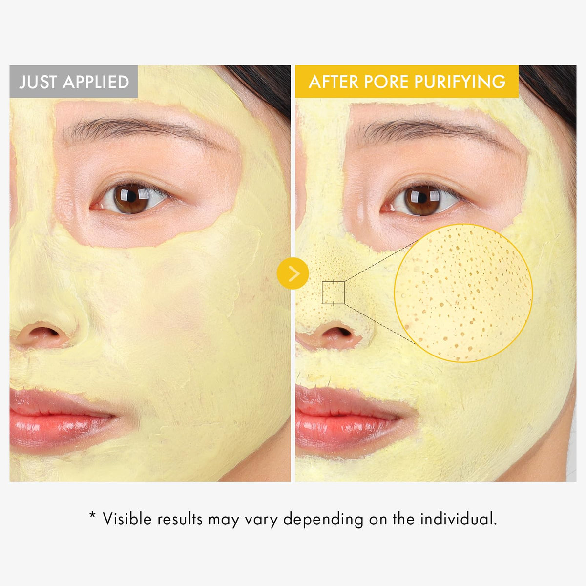 TOSOWOONG application on face demonstrates cooling, quick-dry pore-cleansing effect