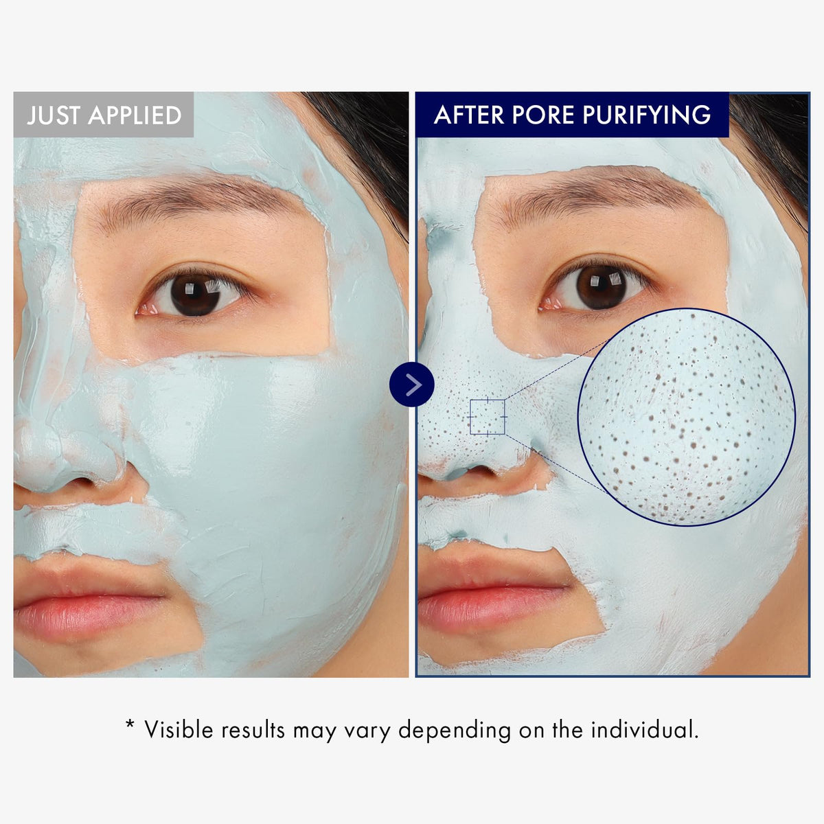 TOSOWOONG mask applied on nose illustrating targeted pore cleaning benefit